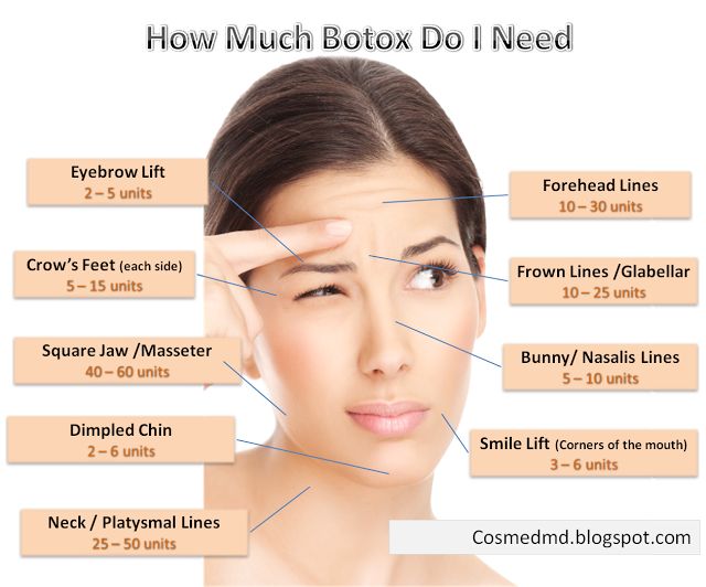 Botox Injections Price In Delhi Dermaworld Skin Clinic